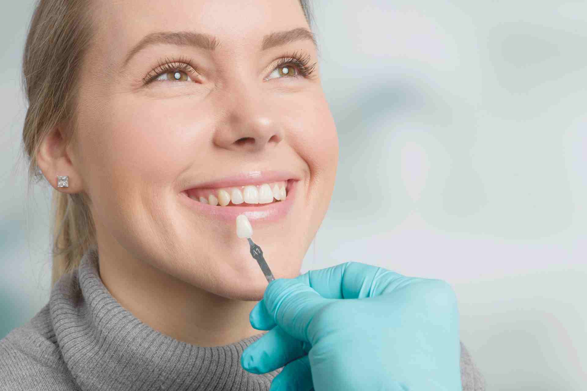 Are Veneers Applied to Individual Teeth?