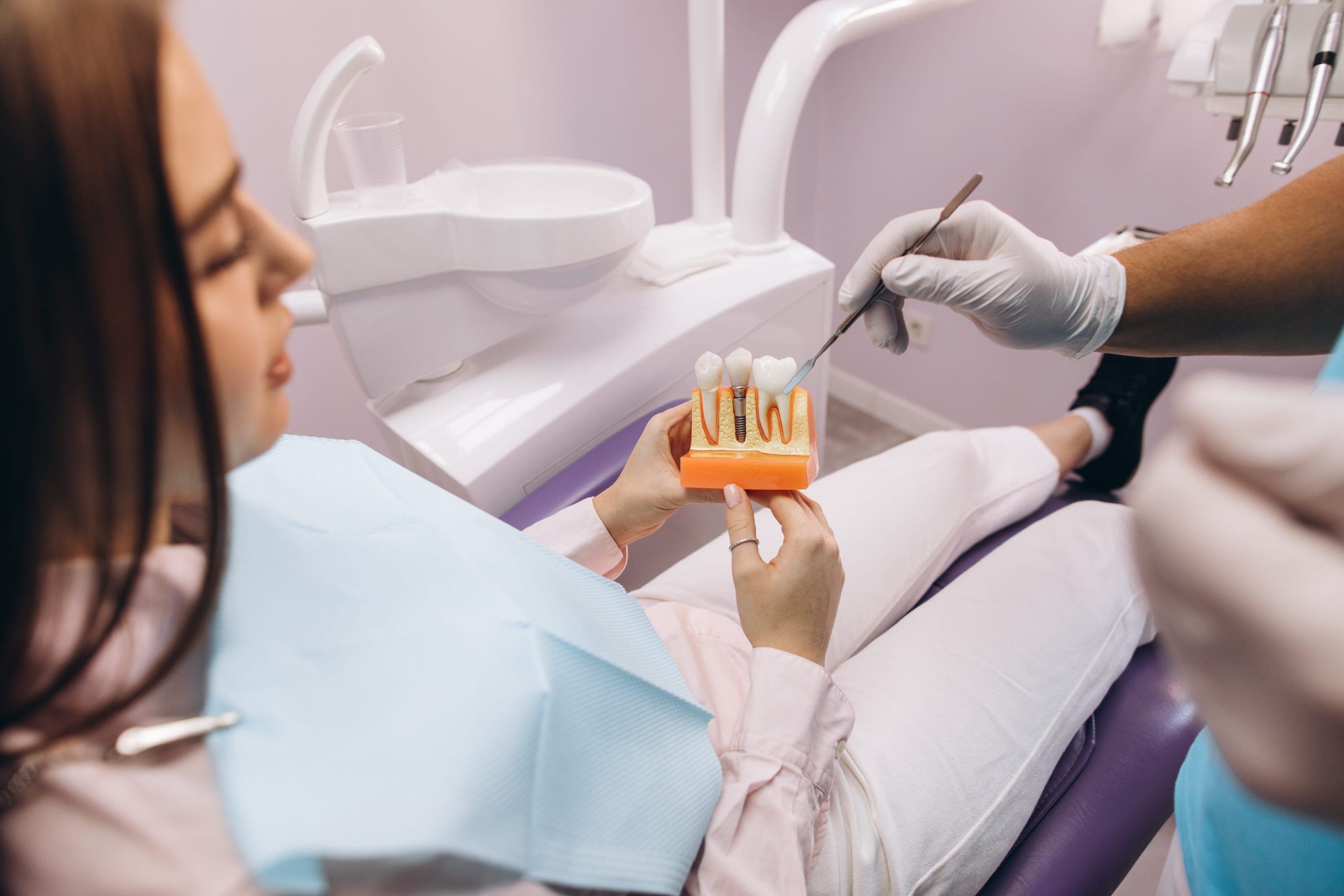 What Are the Advantages of Dental Implants?